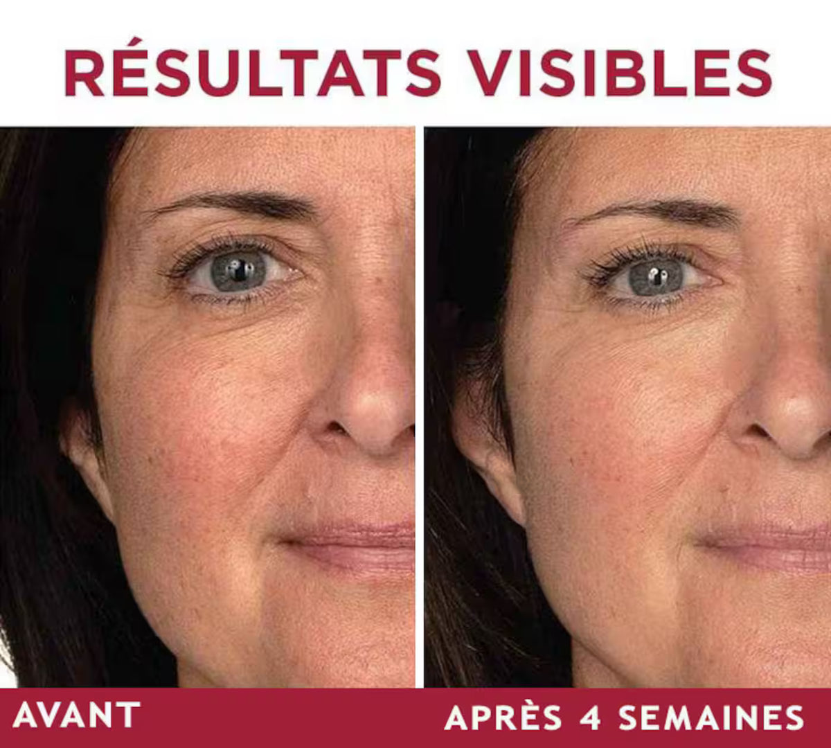 MYOLUNA Lift Pro — Appareil de soin du visage