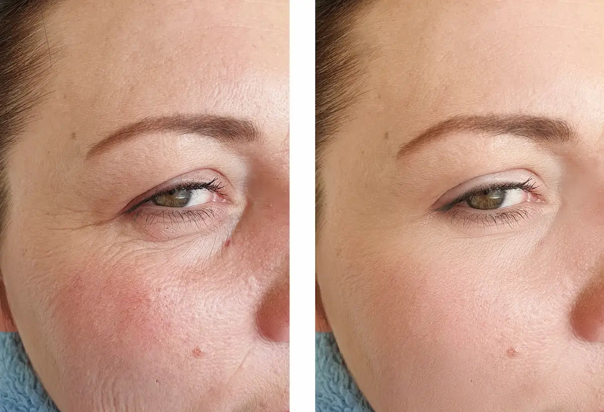 Pack Ritual Duo — La routine complète anti-âge